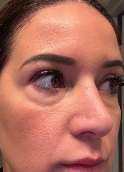 Before photo from Maria Garcia