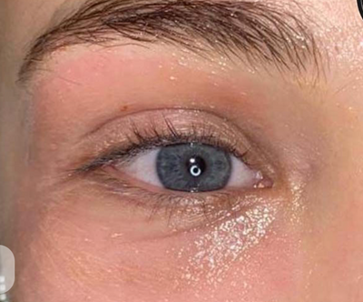 After photo from Emily Chen