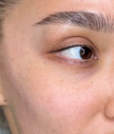 After photo from Sarah Johnson